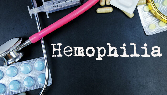 Hemophilia – Symptoms and Effective Treatment Options