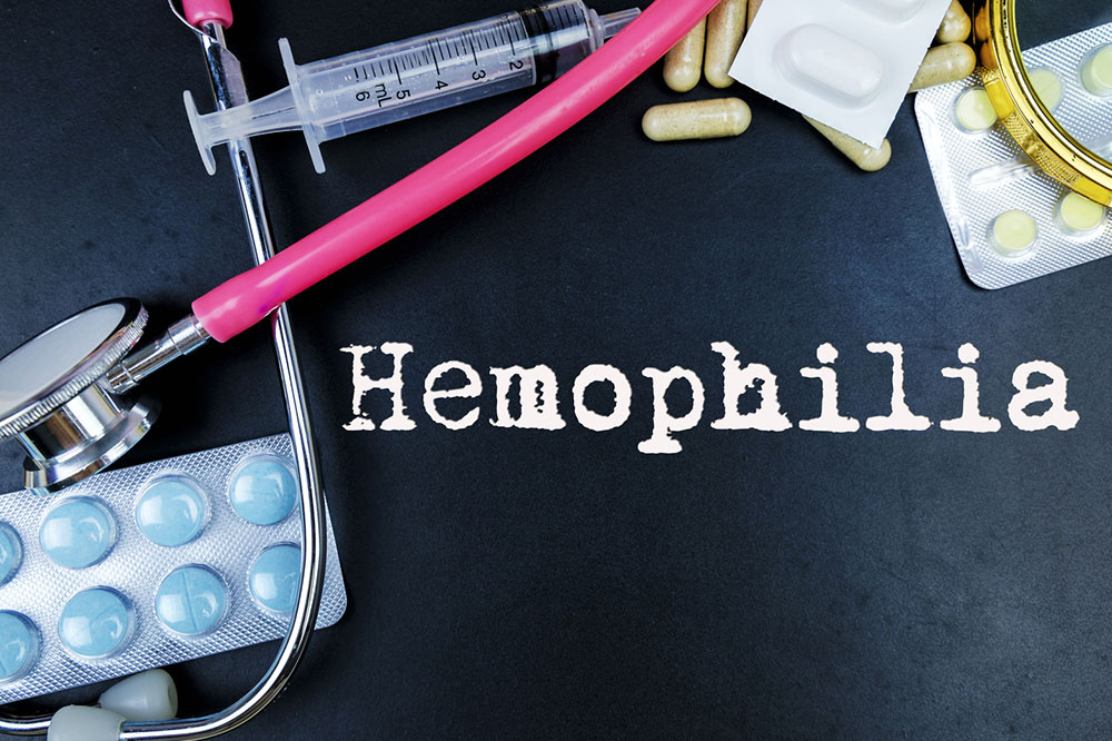 Hemophilia – Symptoms and Effective Treatment Options