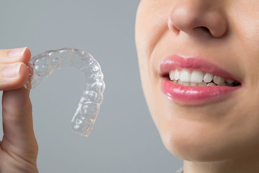 The Top Benefits of Clear Aligners vs. Metal Braces