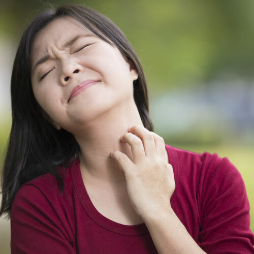 U.S. Cities to Avoid With Eczema