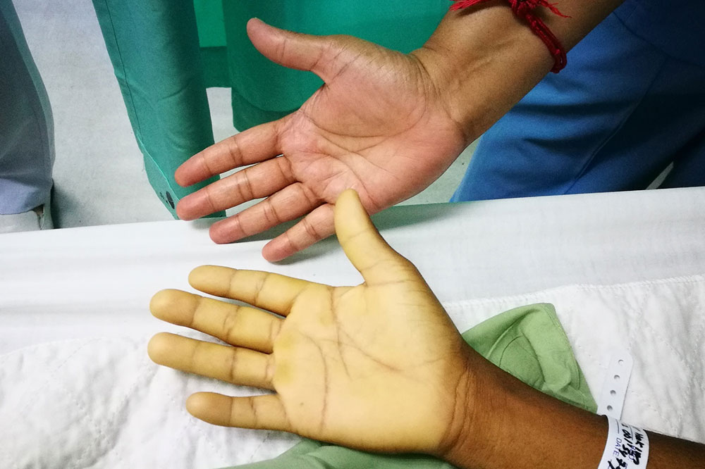 What are the Main Types and Causes of Anemia